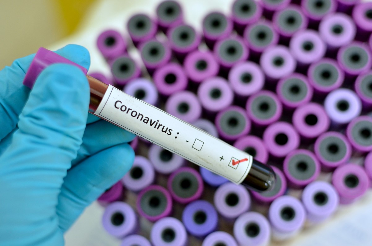 Coronavirus4.jpg