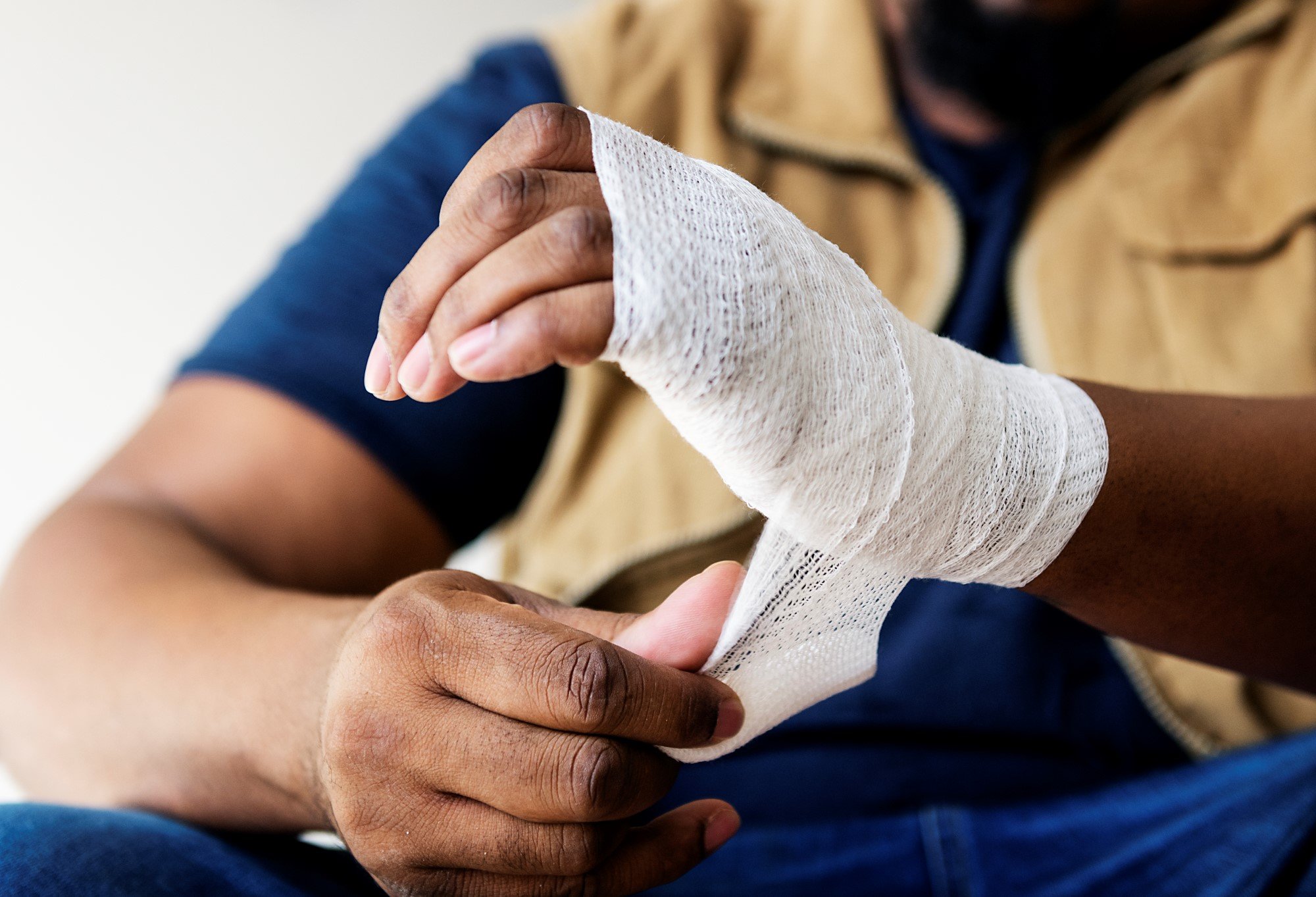 Animal Bites — Know When to Go to the ER Animal Bites — Know When to Go to the ER